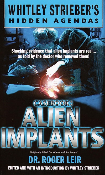 Casebook: Alien Implants
