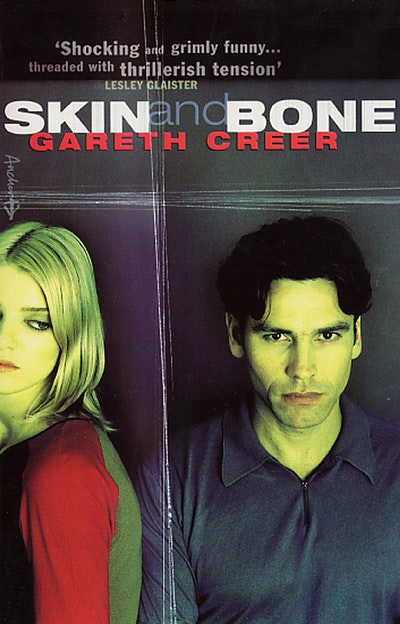 Skin And Bone