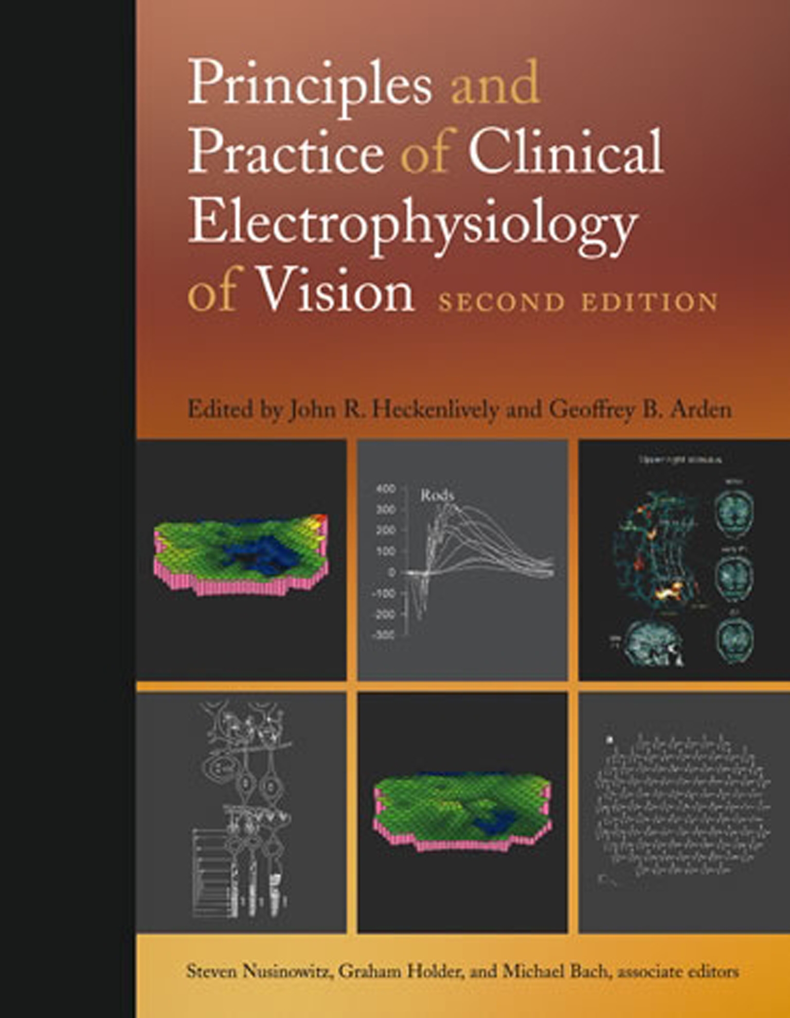 Principles And Practice Of Clinical Electrophysiology Of Vision, Second ...